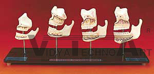 Development of Teeth